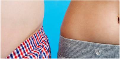 الرجال أكثر عرضة للتجمع الدهون حول البطن ، و ظهور الكرش مقارنة بالنساء ؟